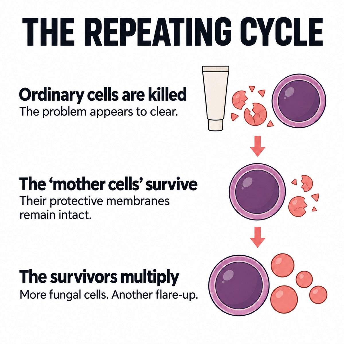 The repeating cycle. 1, ordinary cells are killed and the problem appears to clear. 2, the mother cells survive because their protective membranes remain intact. 3, the survivors multiply: more fungal cells, another flare-up.